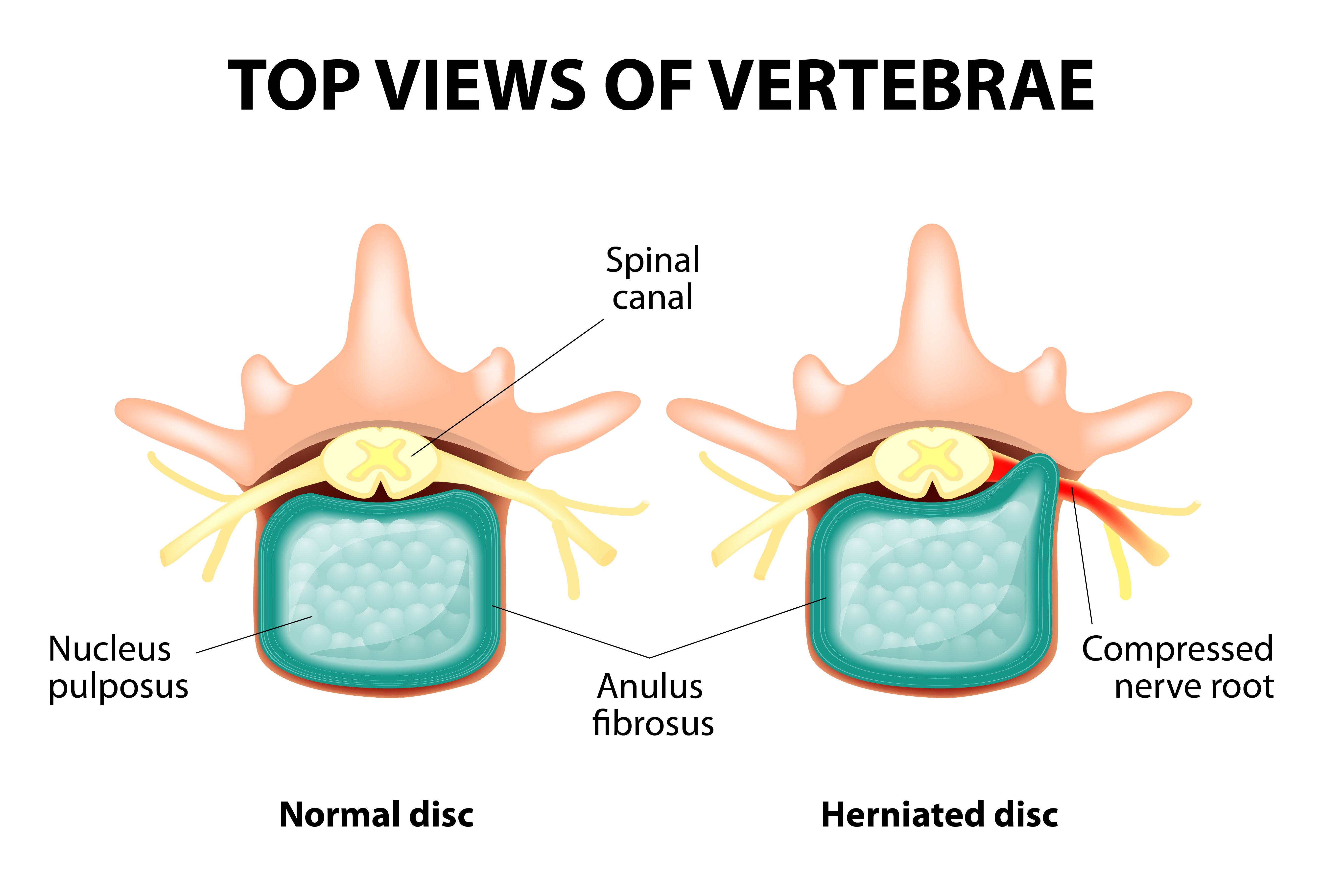 Vertebral Column: Anatomy, vertebrae, joints & ligaments